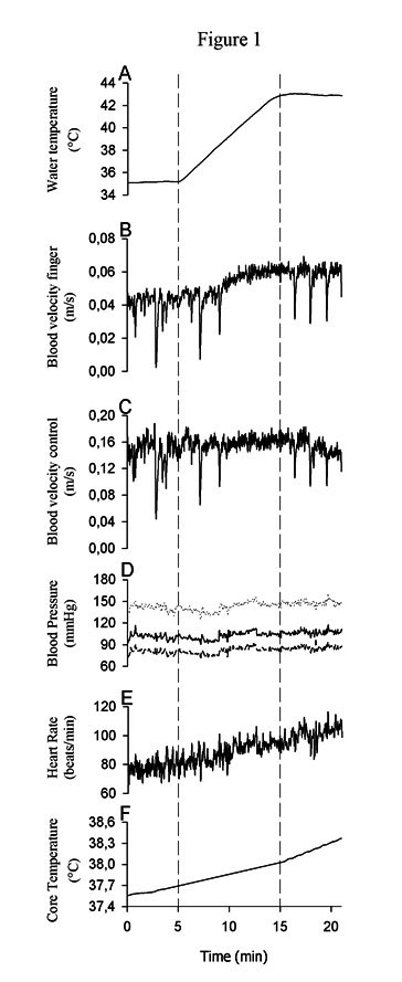 No Evidence of Heat-Induced Vasoconstriction in Human Skin Using Ultrasound Doppler after Passive Whole-Body Heat Stress