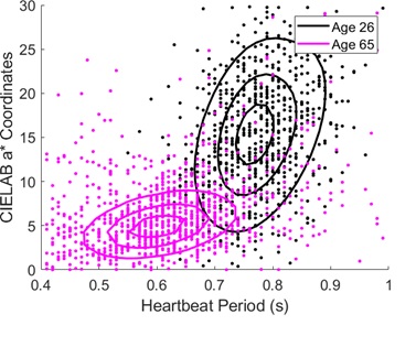 Examination of the Physiological Status of the Human Cardiovascular System In Vivo Through Skin Color Variations