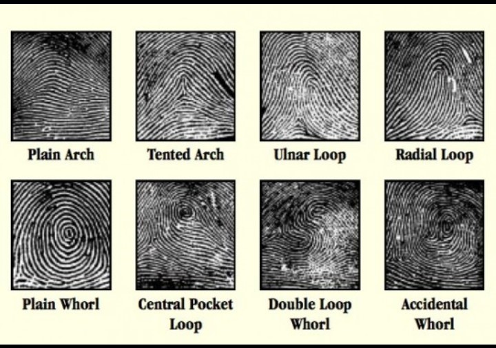 Comparitive Analysis of Lip Prints, Finger Prints, Intercanine Distance Measurement Using Bite Marks and Rugae Pattern in Chhattisgarh Population